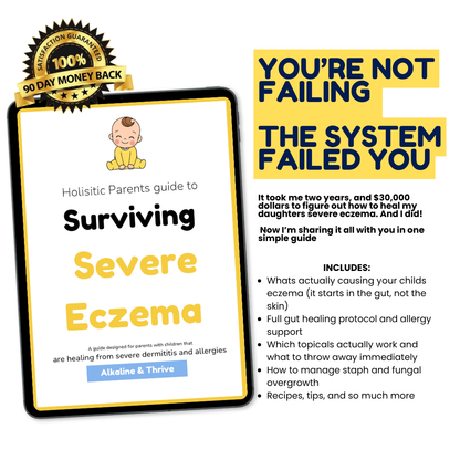 Holistic Parents Guide to Surviving Severe Eczema